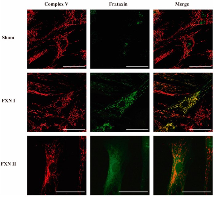 Intracellular localization of frataxin isoform I and II in fibroblasts from FRDA patients.jpg